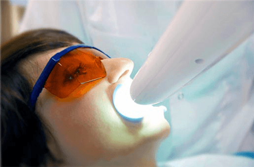 Understanding the Causes of Teeth Sensitivity Southport