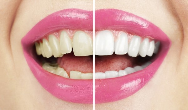 What Early Signs of Oral Cancer Should You Never Ignore Southport?