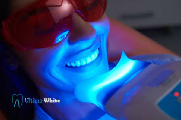 Professional Teeth Whitening Options Southport
