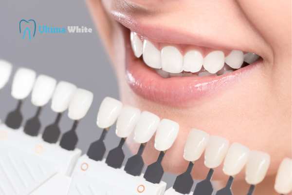 How to Maximise the Results of Your Laser Teeth Whitening Treatment Southport