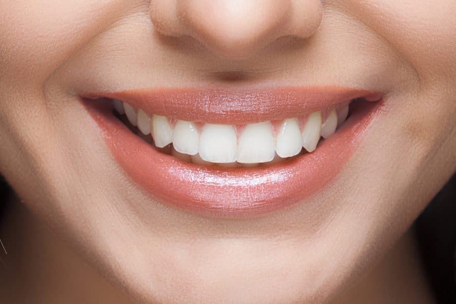 Beyond Whitening: How Your Daily Diet Affects Long-Term Smile Brightness Southport