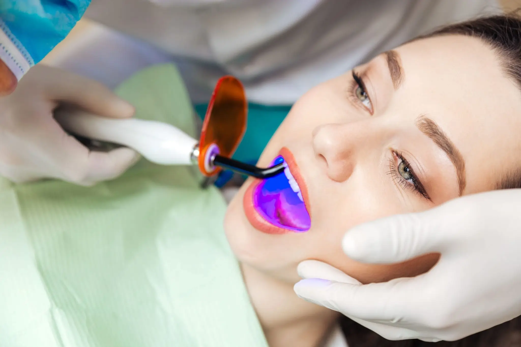 How Do You Choose the Right Teeth Whitening Southport Option for Your Smile?