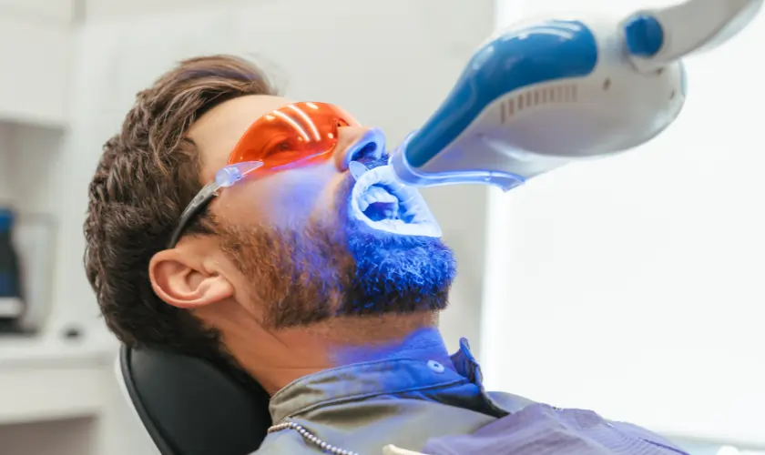 What Is Laser Teeth Whitening and How Does It Work Southport?