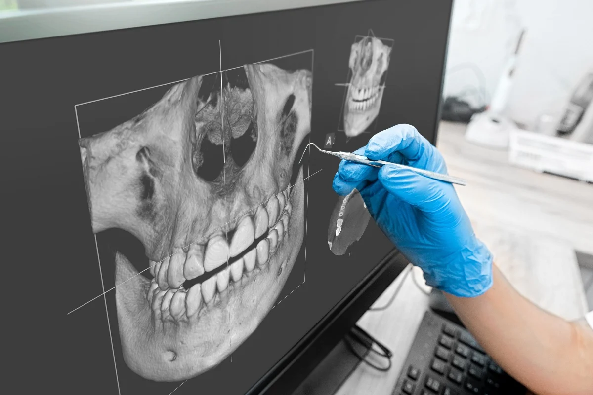 Key Benefits of 3D Printing for Patients and Dentists Southport