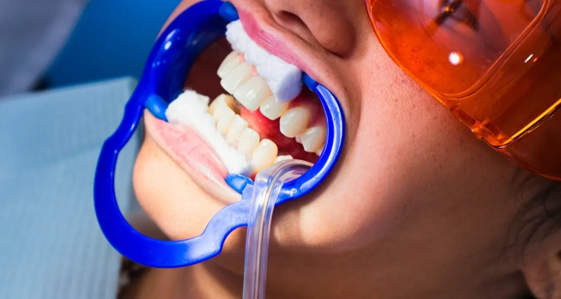 How Can Cosmetic Dentistry Boost Your Confidence Southport