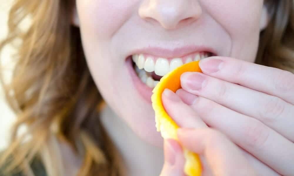 Signs Your Teeth Are Being Damaged by Acid Southport