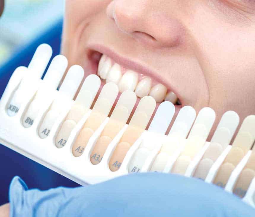 Is Laser Teeth Whitening Worth It for a Brighter, Confident Smile Southport?