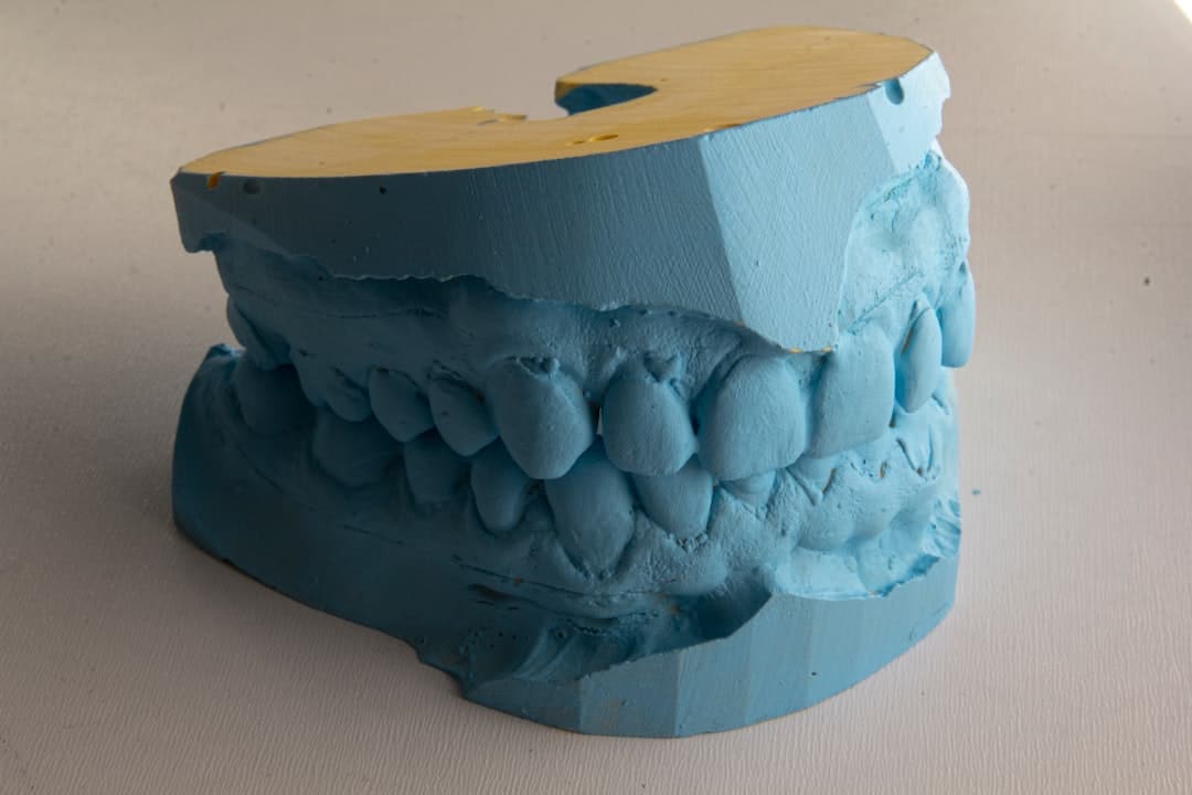How Do Dental Implants Improve Jawbone Health and Oral Function Southport?
