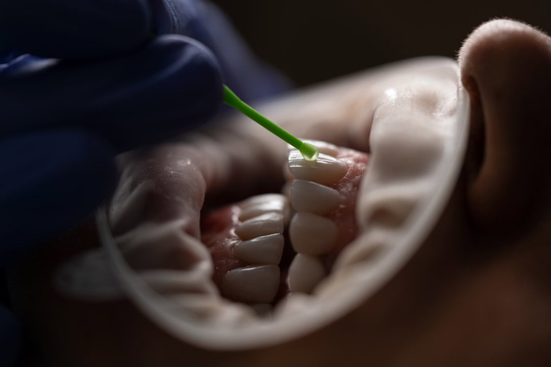 The Role of Saliva: Nature’s Defense System Southport