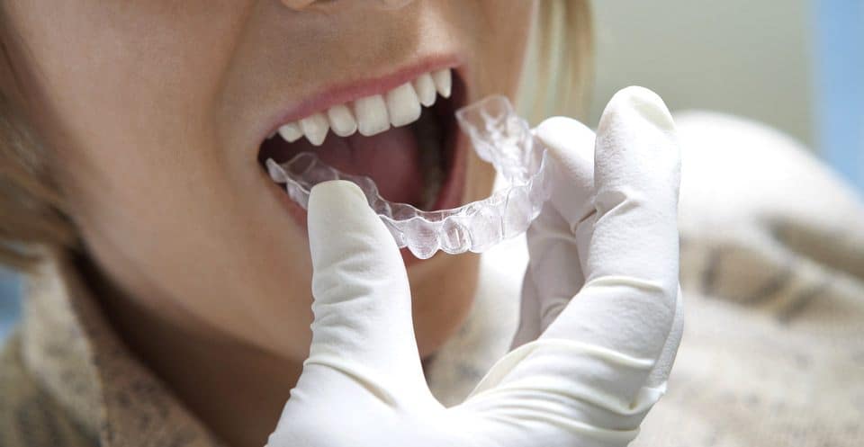 Can Bruxism Affect Your Sleep Quality Southport
