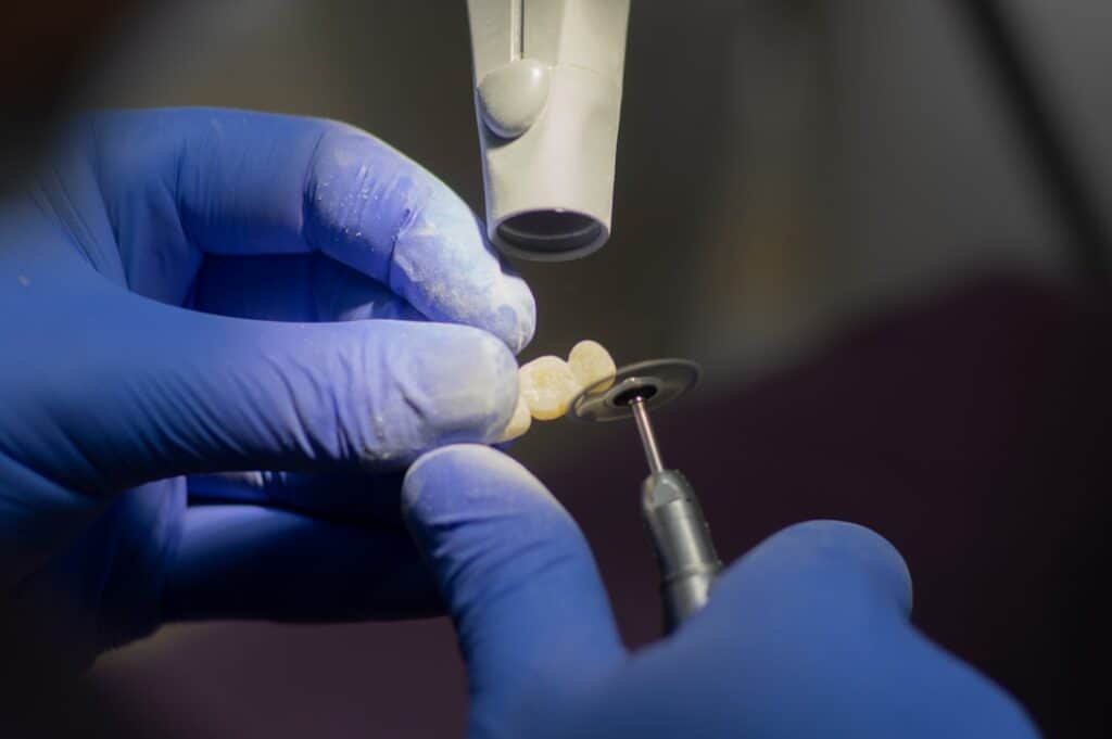 Customised Dental Solutions: Crowns, Aligners, and Implants Southport