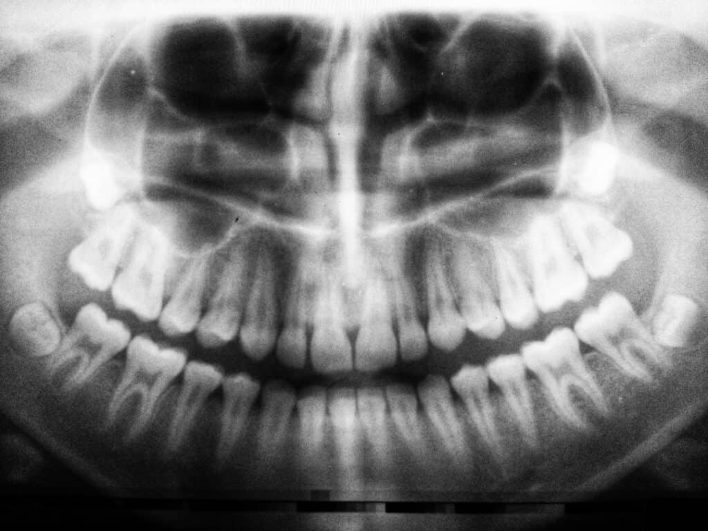 The Future of 3D Printing in Oral Healthcare Southport